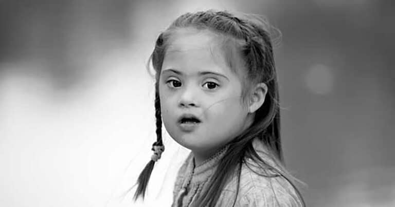 Down syndrome girl